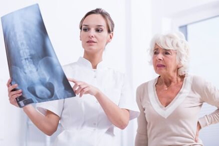 Röntgenonderzoek is een informatieve manier om osteochondrose van de wervelkolom te diagnosticeren