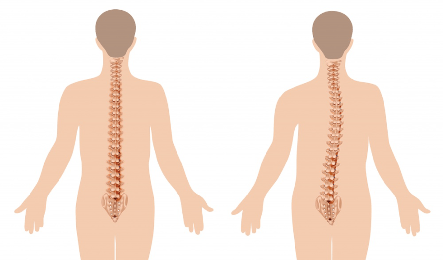 manifestatie van osteochondrose