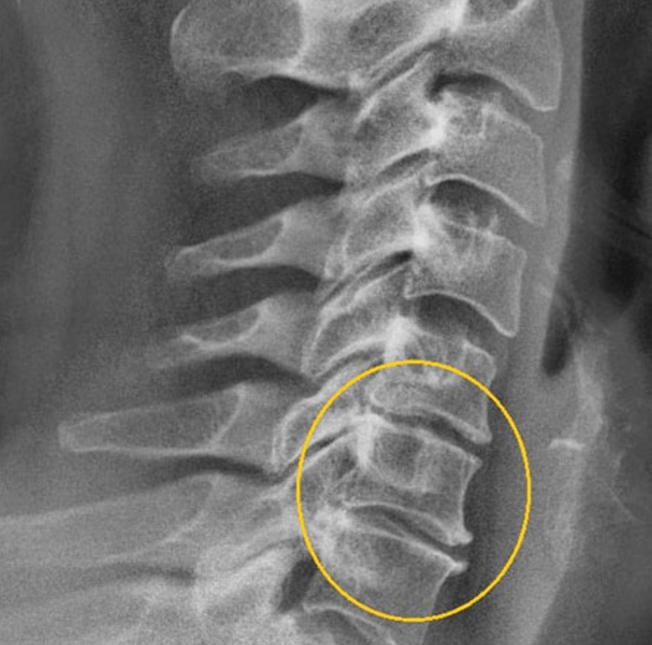 Diagnostisch beeld